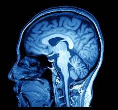 Neuro 2
