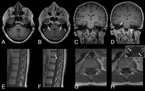 Neuro 3