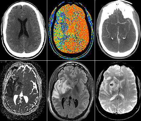 Neuro 4
